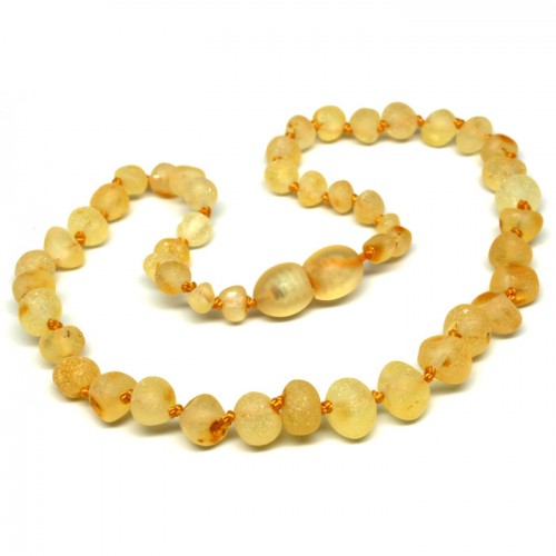 Amber Teething Necklace Review