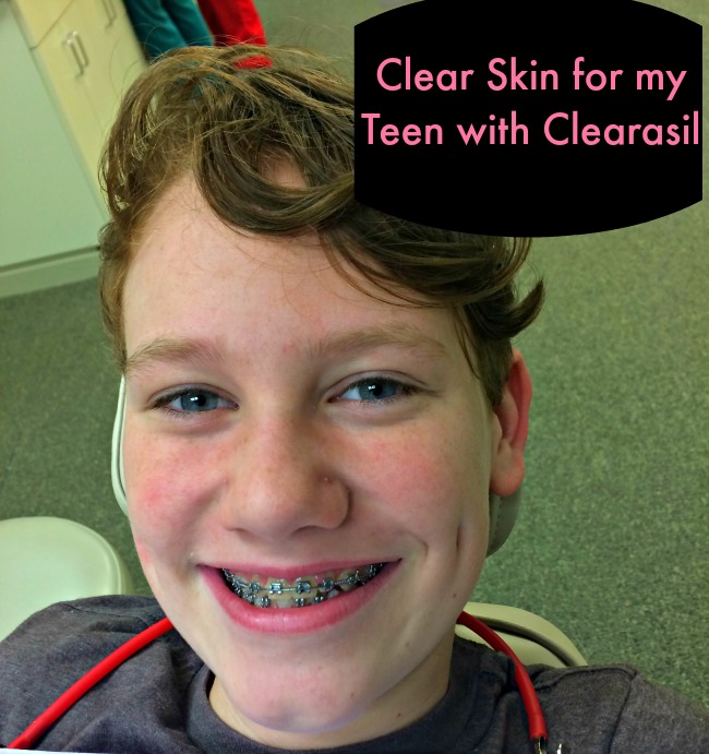 Two Clearasil Products to Banish the Blemishes #ClearasilMom